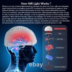 1070nm NIR Light Therapy Brain Helmet for Parkinson Depression Alzheimer Stroke