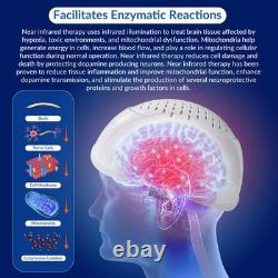 1070nm Near Infrared Light Therapy Brain Helmet for Parkinson Alzheimer Aphasia
