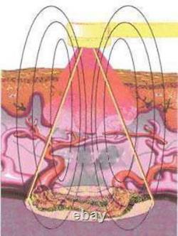 Cold, Soft, Low Level Laser Therapy, LLLT, Pain Relief, Red InfraRed Chiropractic