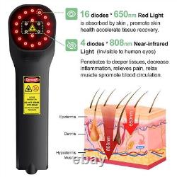 High Power Near Infrared Light Therapy for Skin Care Promote Tissue Regrowth