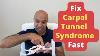 How To Fix Carpal Tunnel Syndrome 3 Powerful Treatments You Haven T Heard Of