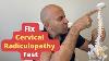 How To Fix Cervical Radiculopathy 3 Powerful Treatments You Haven T Heard Of
