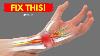 How To Fix Wrist Pain For Good
