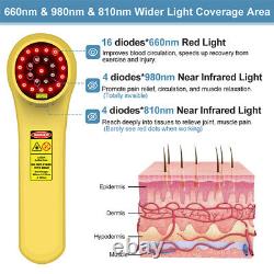 Low Level Laser Light Cold Laser Therapy Powerful Laser for Shingles Nerve Pain