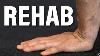 Wrist Pain Strain Sprain Tfcc Rehab Hand Forearm Strength U0026 Mobility Exercises