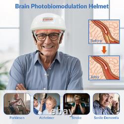 Dispositif de récupération après AVC 1-40Hz Casque LED 810nm pour douleur cérébrale due à Parkinson