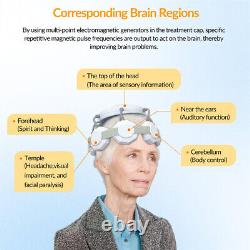 Thérapie TMS : Thérapie par Stimulation Magnétique Transcrânienne pour la Dépression